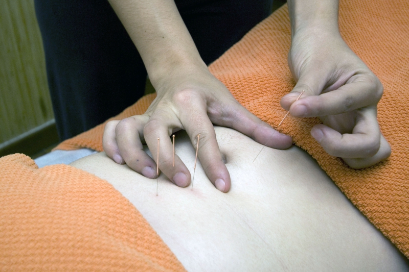 osteopathe-ST LAURENT DU VAR-min_acupuncture-4175625